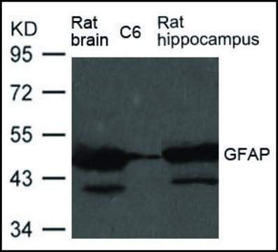 Anti-GFAP antibody produced in rabbit