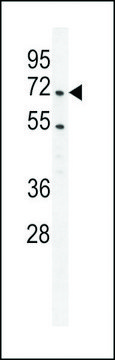 ANTI-PRMT4 (CENTER) antibody produced in