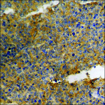 Anti-phospho-p27 Kip1 (pSer¹?) antibody produced