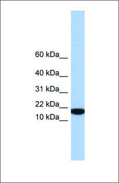 Anti-IL5 antibody produced in rabbit