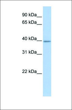 Anti-TXNIP antibody produced in rabbit