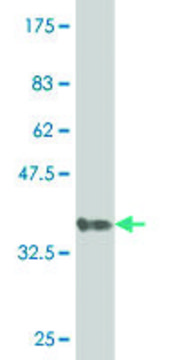 ANTI-GNL3 antibody produced in mouse