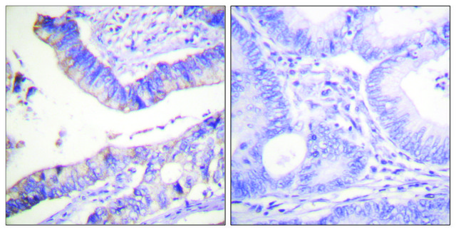 Anti-BCL-2 antibody produced in rabbit