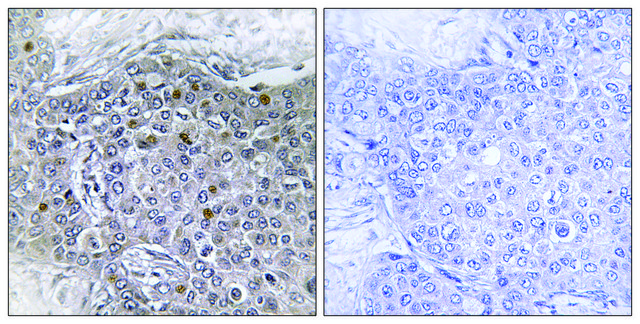 Anti-ZMY11 antibody produced in rabbit