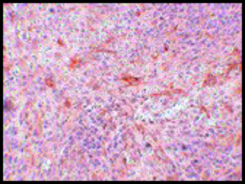 Anti-ABIN3 antibody produced in rabbit