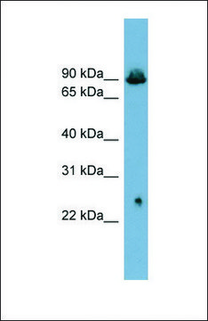 Anti-SLC6A5 antibody produced in rabbit