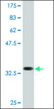 Monoclonal Anti-SLC36A2, (N-terminal) antibody produced