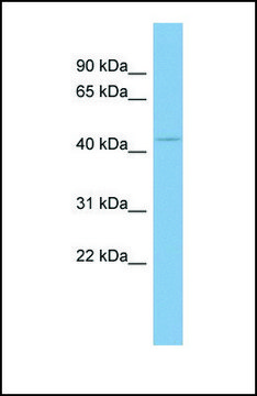 Anti-UGCG antibody produced in rabbit