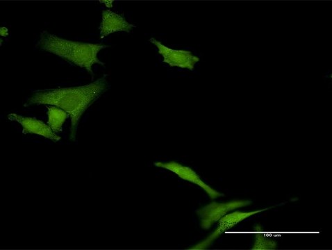 Anti-HABP4 antibody produced in rabbit