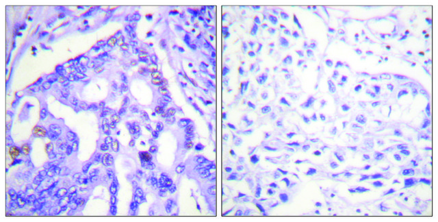 Anti-PIAS4 antibody produced in rabbit