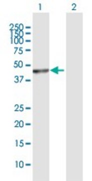 Anti-PUS1 antibody produced in rabbit