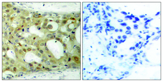 Anti-BCL-2 antibody produced in rabbit