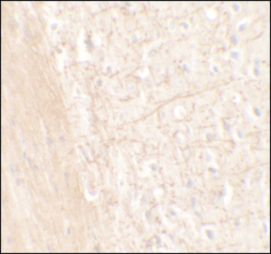 Anti-ERAP1 antibody produced in rabbit