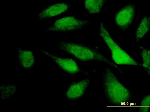 Monoclonal Anti-TNRC6C antibody produced in