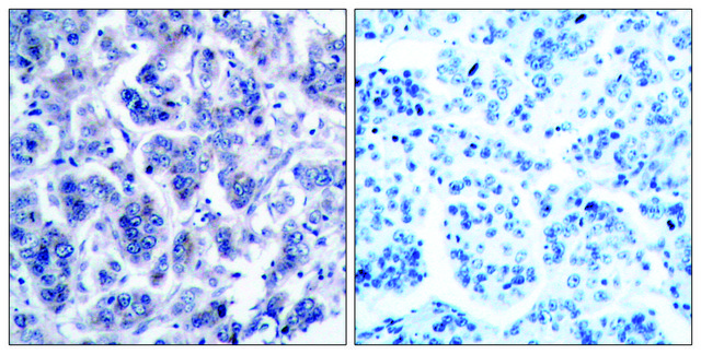 Anti-TYK2 antibody produced in rabbit