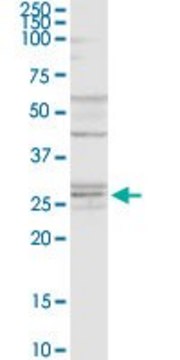 Anti-NAT6 antibody produced in rabbit