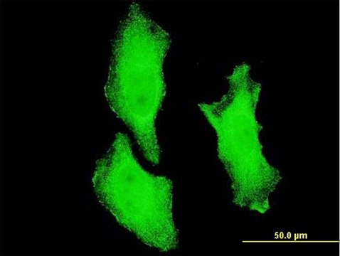 ANTI-CHUK antibody produced in mouse