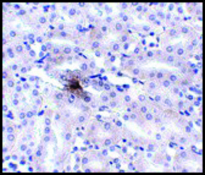 Anti-ZIP11 antibody produced in rabbit