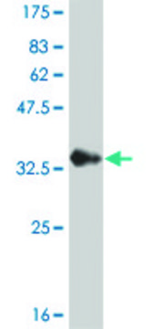 Monoclonal Anti-CHP antibody produced in