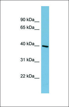 Anti-ST8SIA6 antibody produced in rabbit