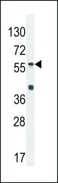 ANTI-SP8 (C-TERM) antibody produced in