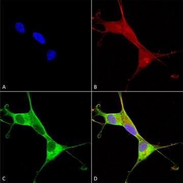 Monoclonal Anti-Ankyrin B antibody produced