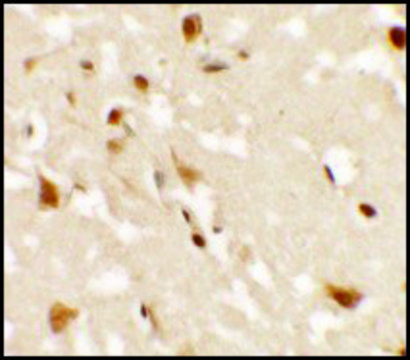Anti-AIG1 antibody produced in rabbit