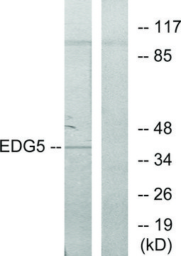 Anti-EDG5 antibody produced in rabbit