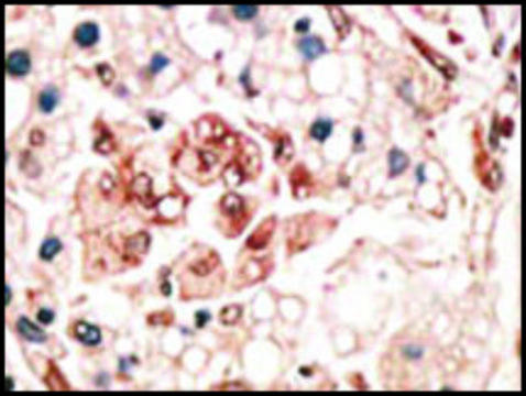 Anti-VILIP3 (center) antibody produced in