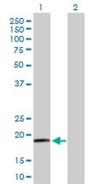 Anti-RPS19 antibody produced in rabbit