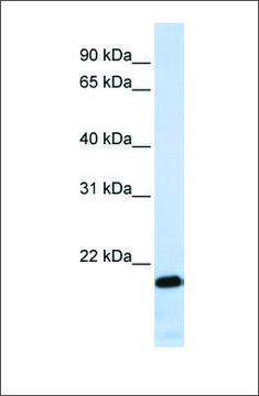 Anti-ZNF428 antibody produced in rabbit