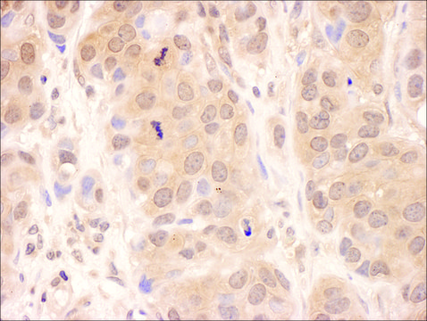 Rabbit anti-USP8 Antibody, Affinity Purified