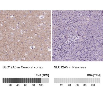 Anti-SLC12A5 antibody produced in rabbit