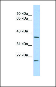 Anti-MTHFD2L antibody produced in rabbit