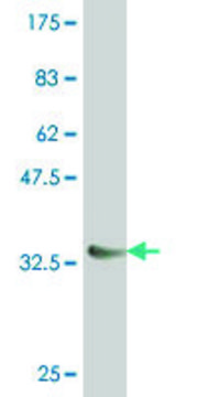 Monoclonal Anti-NKX6-1 antibody produced in