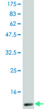 Monoclonal Anti-CSF2, (C-terminal) antibody produced