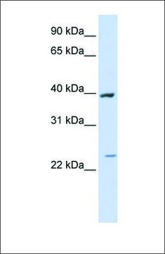Anti-ACADL antibody produced in rabbit