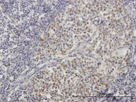 ANTI-ZNF296 antibody produced in mouse