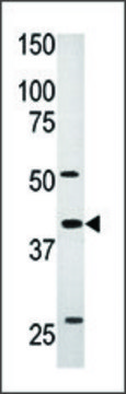 Anti-ART5 (C-term) antibody produced in
