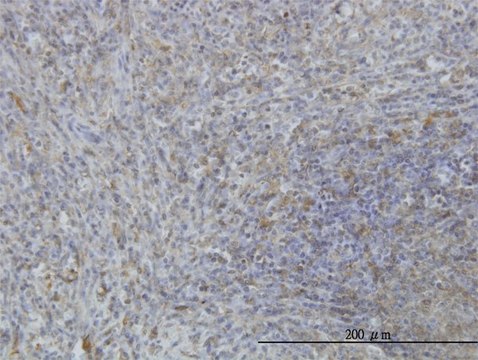 Monoclonal Anti-MARCKS antibody produced in