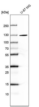 Anti-SEC24A antibody produced in rabbit