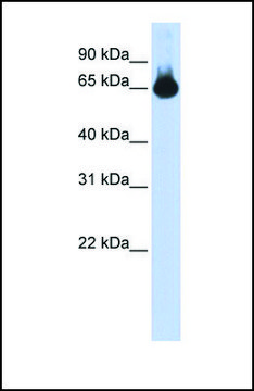 Anti-FOXG1, (N-terminal) antibody produced in