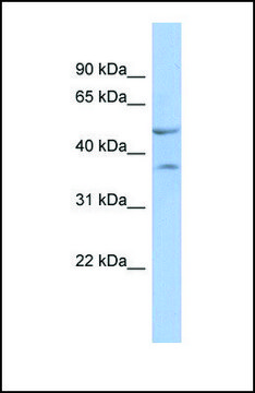 Anti-NKX6-1, (N-terminal) antibody produced in