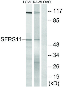 Anti-SFRS11 antibody produced in rabbit