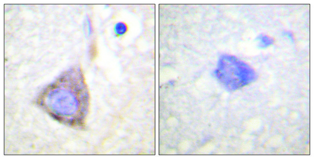 Anti-BCR antibody produced in rabbit