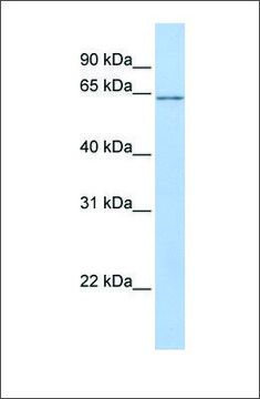Anti-ANGPTL2 antibody produced in rabbit