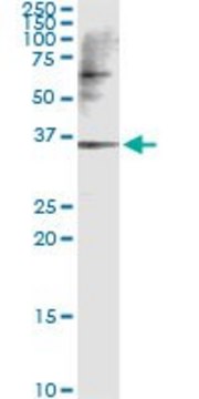 Monoclonal Anti-CAMK1D antibody produced in