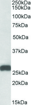 Anti-ETFB (C-terminal) antibody produced in