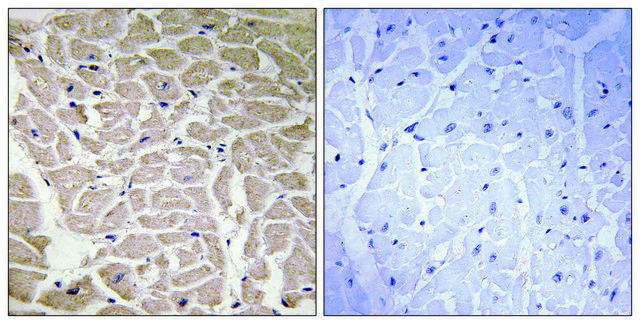 Anti-Collagen XVI ?1 antibody produced
