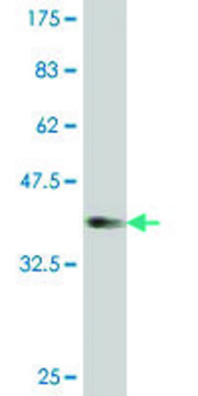 ANTI-PTCH antibody produced in mouse